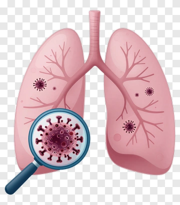 Illustration Of Lungs With Virus Under Magnifying Glass PNG