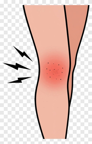 Painful Knee Injury Illustration PNG