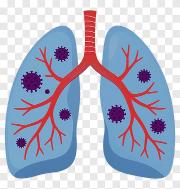 Lungs With Virus Illustration PNG