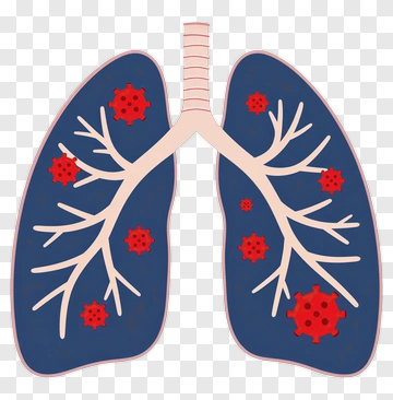 Illustration Of Lungs With Virus Representation PNG