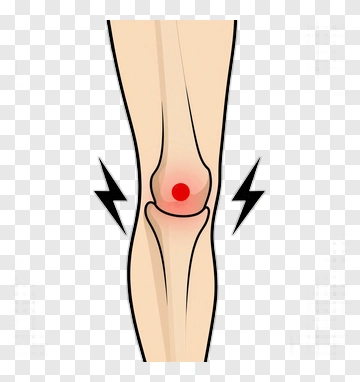 Knee Joint Pain Illustration PNG