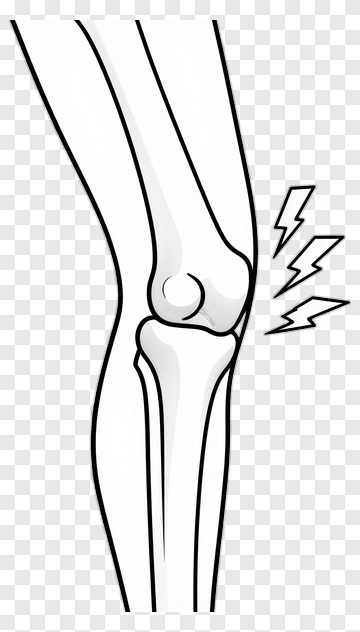 Knee Joint With Pain Indicators PNG